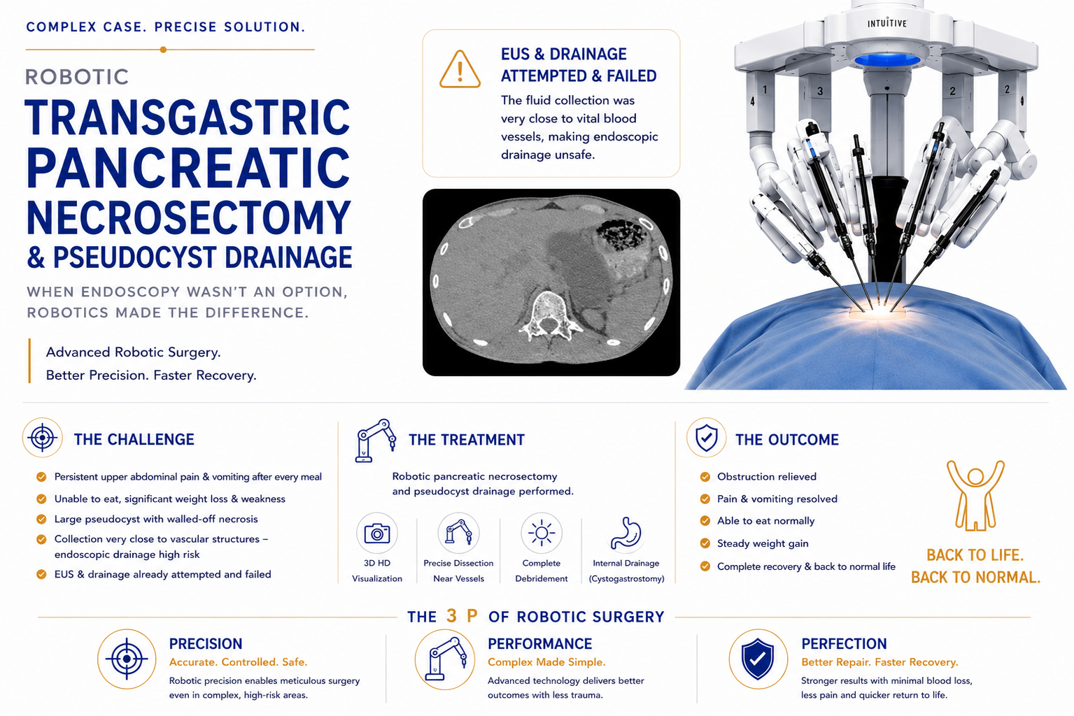 Our complex pancreatic pseudocyst case was featured in the Times of India — a 24-year-old, unable to eat for three months, treated successfully with r