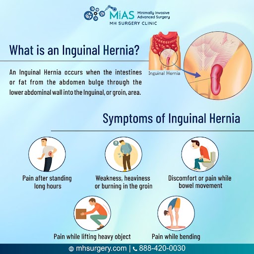 Symptoms of Inguinal Hernia