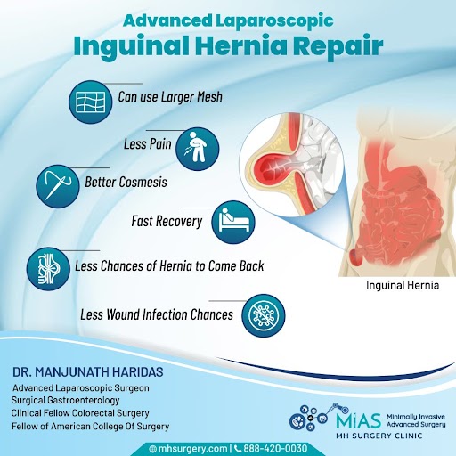 Advanced inguinal hernia repair Bangalore