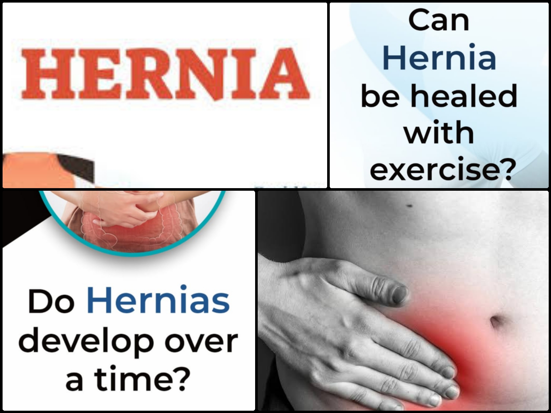 Signs you need to see a hernia specialist for your hernia?