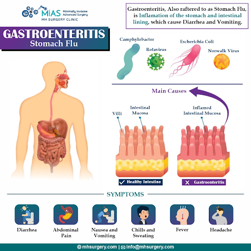 acute gastroenteritis symptoms