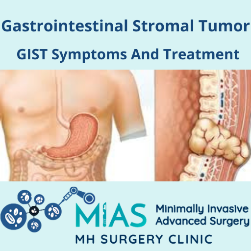 GIST Symptoms And Treatment | Gastrointestinal Stromal Tumor