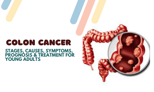 Colon Cancer: Stages, Causes, Symptoms, Prognosis & Treatment For Young Adults